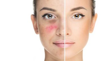 For skin complaints